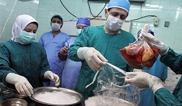 ايران تتبوّأ الصدارة عالمياً في عمليات زراعة الكبد