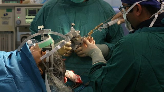 طریقة مبدعة للباحثین الإيرانیین في علاج الأورام الخبیثة للدماغ