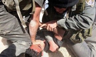 حمله وحشیانه نظامیان رژیم صهیونیستی به جوان 17 ساله فلسطینی+تصویر