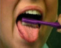 هر چند روز یک بار، روی زبان را مسواک بزنید