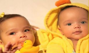یک چهارم دوقلوهای همسان گرفتار ام اس هستند