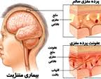 ابتلاء سالانه یک میلیون و دویست هزار نفر در دنیا به بیماری مننژیت