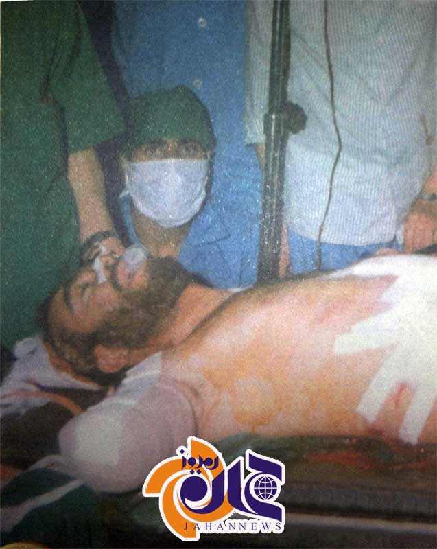 وقتی دست شهیدخرازی قطع شد (عکس)