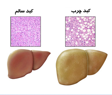 پاک کننده هاي طبيعي کبد