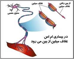 شبانه، از بیماری ام.اس پیشگیری می کند