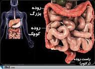بیماری التهابی روده‌ها
