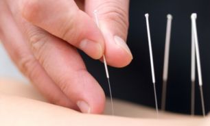 طب سوزني با كنترل از راه دور