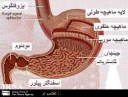 مسمومیت های غذایی ازعلل بروز بیماری گاستریت