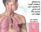 سل یک بیماری عفونی