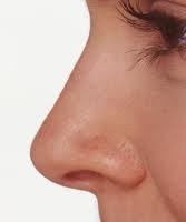موقع شکستگی بینی چه باید کرد؟