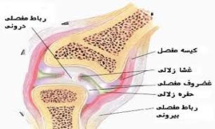 چرا مفصلهایتان صدا می دهد؟