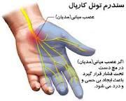 چگونگی رفع خواب رفتن دست