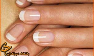 دلایل شکسته شدن ناخن های بلند در خانم ها چیست؟