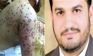 جراحت شديد نماينده جمعيت وفاق بحرين در تيراندازي رژيم آل خليفه