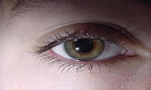 اختلال دید شبانه نشانه آب سیاه است