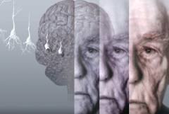 ورزش علائم آلزایمر را كاهش می‌دهد