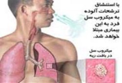 یك بیمار مبتلا به 'سل' در كهگیلویه و بویراحمد شناسایی شد