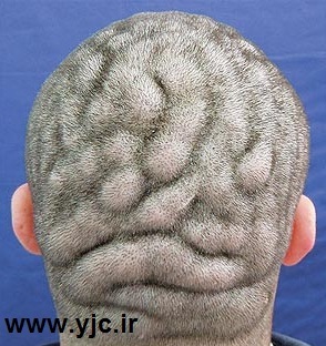 مردی با جمجمه نرم +عکس