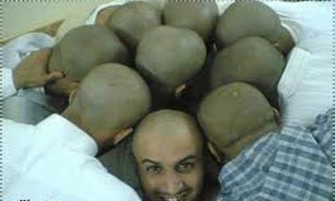 کچل‌ها بخوانند