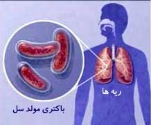 ارائه خدمات رايگان درمان برای مبتلايان به سل در مشهد
