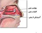 پولیپ بینی و خطرات آن!