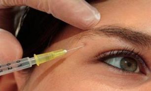 آرایشگاه ها به هیچ وجه حق دخالت در امور درمانی را ندارند