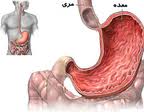 اردبیل نیازمند ایجاد مرکز درمان و پیشگیری از سرطان گوارش است
