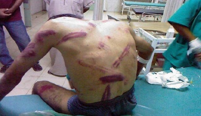 شکنجه در رژیم آل خلیفه نهادینه شده است