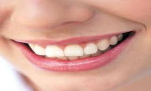 آمالگام یا کامپوزیت، کدامیک برای ترمیم دندان ها مناسب تر است؟