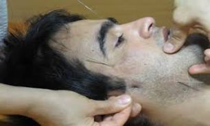 اگر دچار این علائم هستید فلج صورت در انتظار شماست