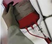 تب و كاهش وزن در بيماران مسلول HIV مثبت شايع‌تر از بيماران HIV منفي است