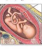 خطرناک ترین وسیله برای زنان باردار