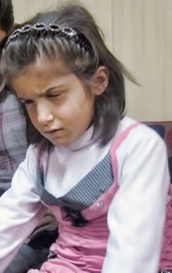 جراحی چشمان شوخان توسط وزیر بهداشت