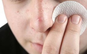 دارویی برای تسکین نیش زنبور، گزیدگی حشرات و جوش های ریز