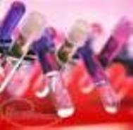 تبدیل اسید فسفریک صنعتی به خوراکی در تبریز