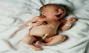 نمونه گیری آزمایشی از خون بند ناف نوزادان کرمانشاهی برای نگهداری در بانک خون بند ناف عمومی