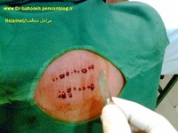 چه افرادی مجاز به انجام حجامت نیستند؟