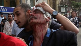 درگيري افراد ناشناس با تظاهركنندگان مصری