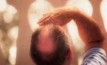 یک راه ساده برای حفظ موی سر