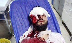 محاکمه جواني که موجب عدم بینایی یک "طلبه" شد ، ادامه دارد+عکس