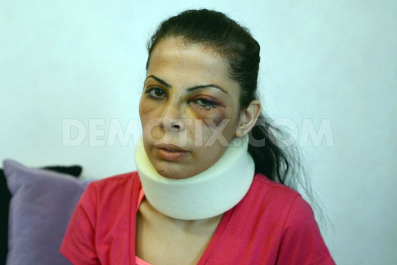 صهيونيست‌ها يک زن فلسطيني را کتک زدند+ عکس
