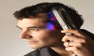 ریزش روزانه 100 تار مو طبیعی است