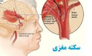 شیوع بیش از 53 درصد از سکته های مغزی در مردان