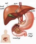 افراد لاغر مراقب افزایش صفرا در ماه رمضان باشند