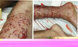 تیراندازی به سمت بحرینی‌ها از فاصله 4 متری