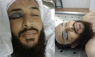 هلاکت فرمانده میدانی جبهه النصره "محمد عبدالرحمان الغلبان" در درعا
