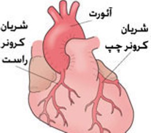 مهلت ارسال آثار به کنگره ی بین المللی پیشگیری از بیماری های عروق کرونر