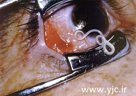 ترسناک ترین انگل های دنیا +عکس