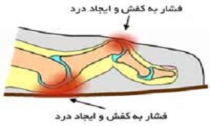 استفاده از کفش های نامناسب موجب بروز مشکلات قامتی می شود