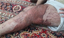 گریه‌های مادری که رنج بیماری پسرش چین و چروک صورتش را بیشتر کرد + تصاویر